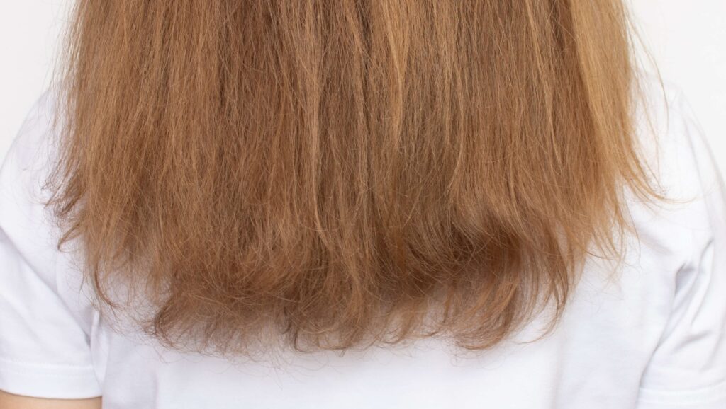 shoulder-length dry hair that needs moisture